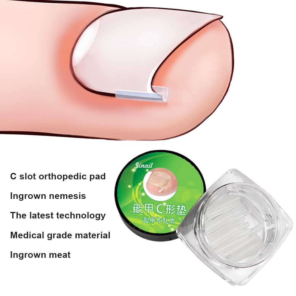 Aa 【In Stock】10Pcs Nail Pads Ingrown Nail Braces Ingrown Nail Artifacts Orthopedic Artifacts Orthopedic Nail Groove Pad Ingrown Toe Nail Correction Pad Paronychia Correction Curved Pad Ingrown Nail Co